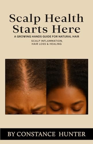 Scalp Health Starts Here From Root to Tip: a Growing Hands Guide for Natural Hair
