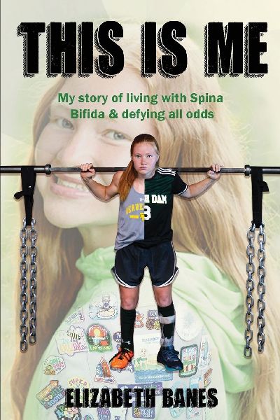 This Is Me: My story of living with Spina Bifida & defying all odds