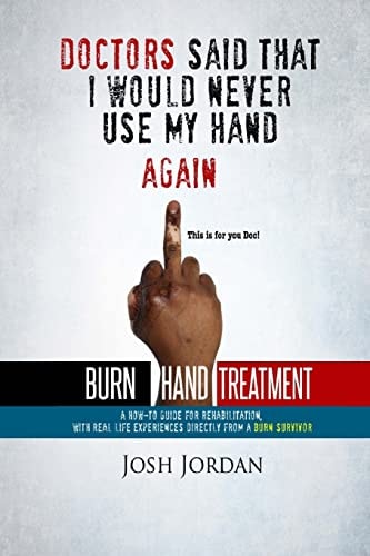 Burn Hand Treatment A How-To Guide for Rehabilitation with Real Life Experiences from a Burn Survivor