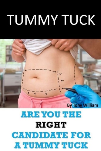 Tummy Tuck Are You The Right Candidate For A Tummy Tuck