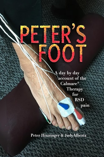 Peter's Foot Calmare Treatment for RSD Pain Relief