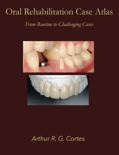 Oral Rehabilitation Case Atlas From Routine to Challenging Cases