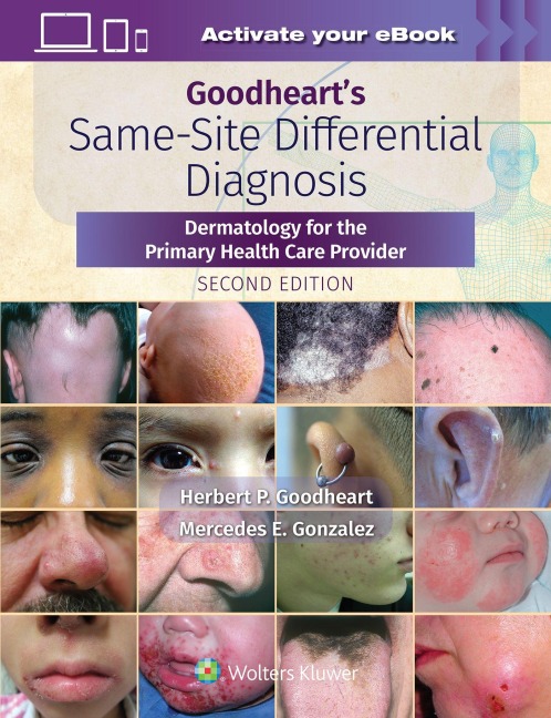 Goodhearts Same-Site Differential Diagnosis: Dermatology for the Primary Health Care Provider