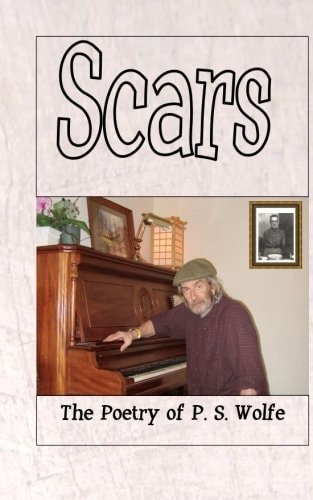 Scars