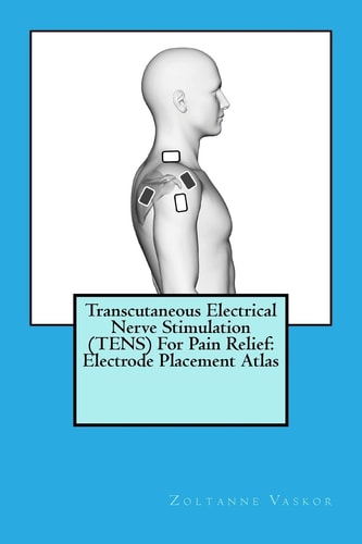 Transcutaneous Electrical Nerve Stimulation (TENS) For Pain Relief Electrode Placement Atlas