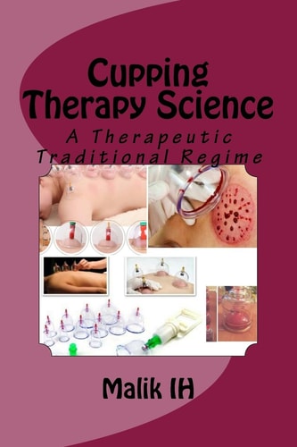 Cupping Therapy Science A Therapeutic Traditional Regime