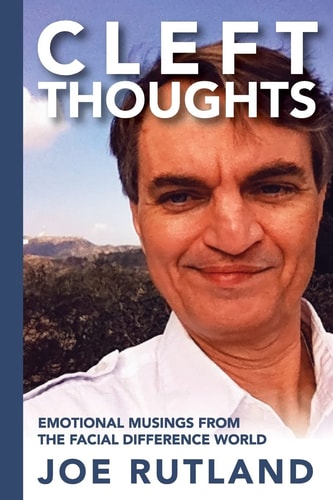 CleftThoughts Emotional Musings From The Facial Difference World