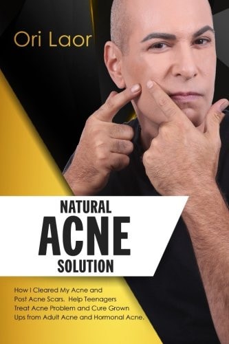 Natural Acne Solution How I Cleared My Acne and Post Acne Scars. Help Teenagers Treat Acne Problem and Cure Grown Ups from Adult Acne and Hormonal Acne