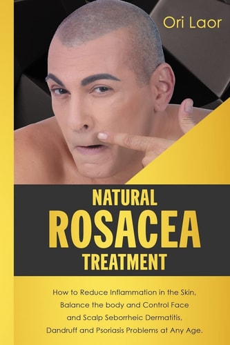 Natural Rosacea Treatment How to Reduce Inflammation in the Skin, Balance the Body and Control Face and Scalp Seborrheic Dermatitis, Dandruff and Psoriasis Problems at Any Age.