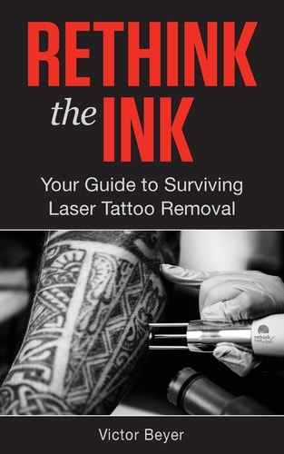 Rethink the Ink Your Guide to Surviving Laser Tattoo Removal