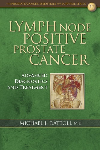 Lymph Node Positive Prostate Cancer Advanced Diagnostics and Treatment