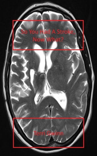 So You Had a Stroke Now What?
