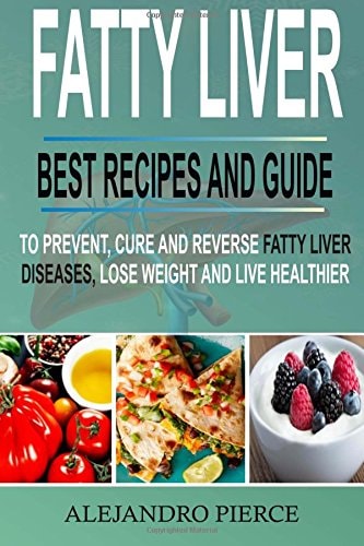 Fatty Liver Best Recipes and Guide to Prevent, Cure and Reverse Fatty Liver Diseases, Lose Weight & Live Healthier