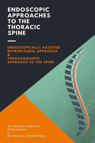 Endoscopic Approaches to the Thoracic Spine Endoscopically Assisted Retropleural Approach and Thoracoscopic Approach to the Spine