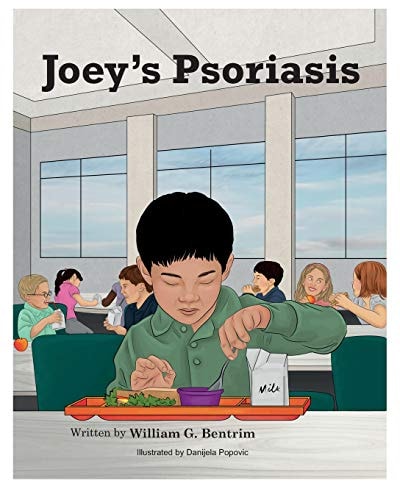 Joey's Psoriasis Explaining Psoriasis To Children