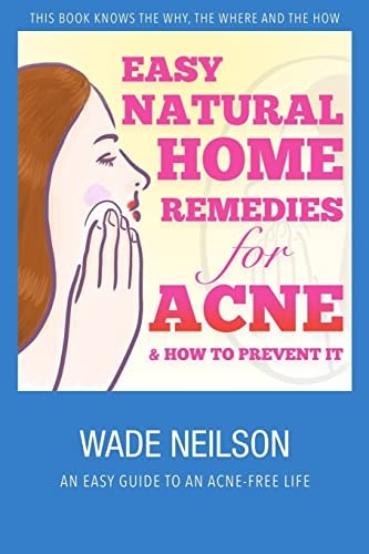 Acne Easy Natural Home Remedies for Acne & How to Prevent It