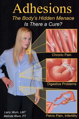 Adhesions The Body's Inner Menace - Is There a Cure?