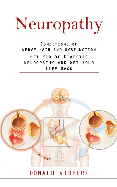 Neuropathy: Conditions of Nerve Pain and Dysfunction (Get Rid of Diabetic Neuropathy and Get Your Life Back)
