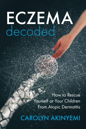 Eczema Decoded How to Rescue Yourself Or Your Children from Atopic Dermatitis
