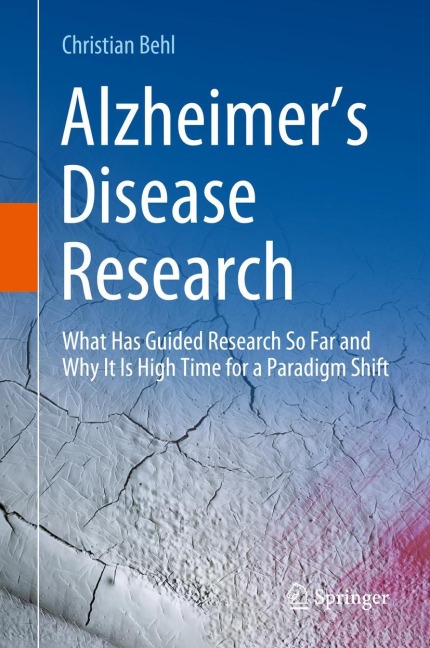 Alzheimers Disease Research: What Has Guided Research So Far and Why It Is High Time for a Paradigm Shift