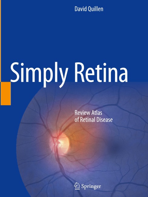 Simply Retina: Review Atlas of Retinal Disease
