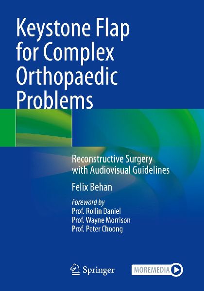 Keystone Flap for Complex Orthopaedic Problems: Reconstructive Surgery with Audiovisual Guidelines