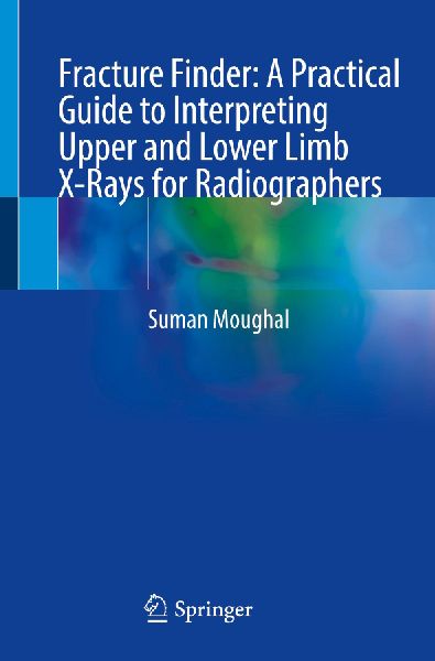 Fracture Finder: A Practical Guide to Interpreting Upper and Lower Limb X-Rays for Radiographers
