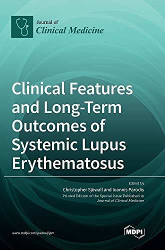 Clinical Features and Long-Term Outcomes of Systemic Lupus Erythematosus