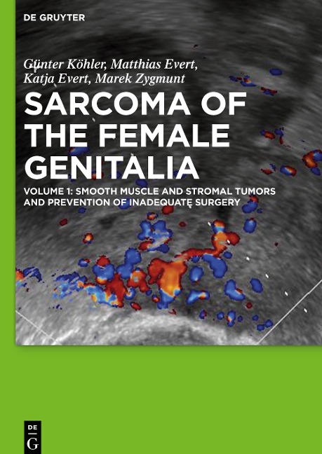 Smooth muscle and stromal tumors and prevention of inadequate surgery