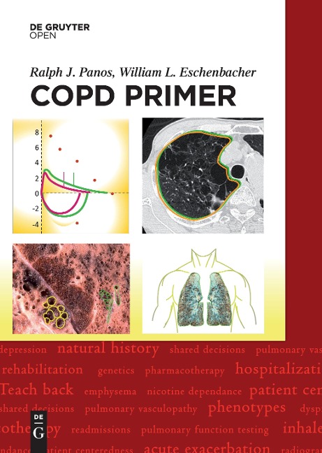 A COPD Primer