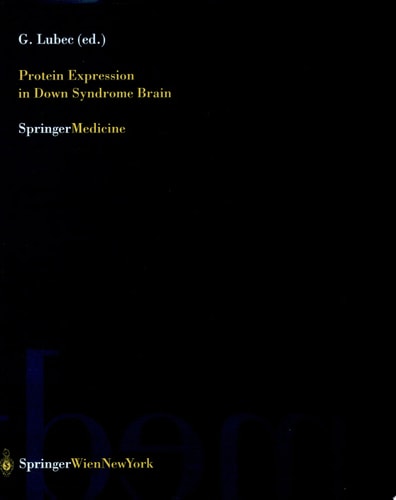 Protein Expression in Down Syndrome Brain