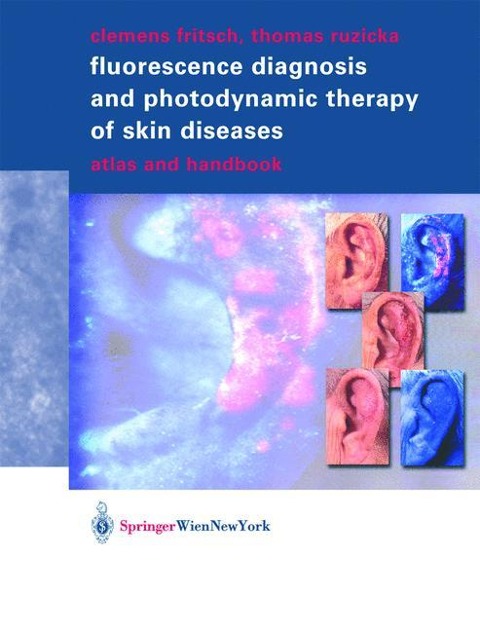 Fluorescence Diagnosis and Photodynamic Therapy of Skin Diseases: Atlas and Handbook