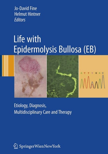 Life with Epidermolysis Bullosa (EB) Etiology, Diagnosis, Multidisciplinary Care and Therapy