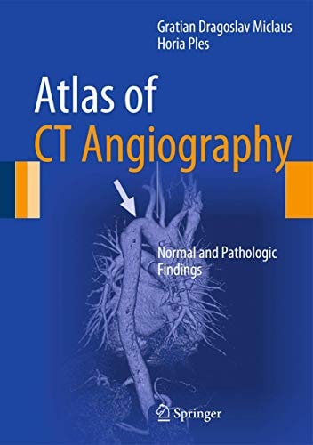 Atlas of CT Angiography Normal and Pathologic Findings