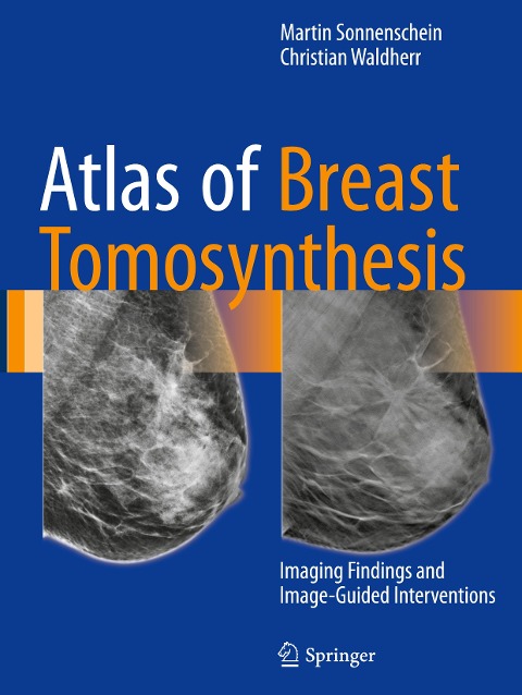 Atlas of Breast Tomosynthesis: Imaging Findings and Image-Guided Interventions