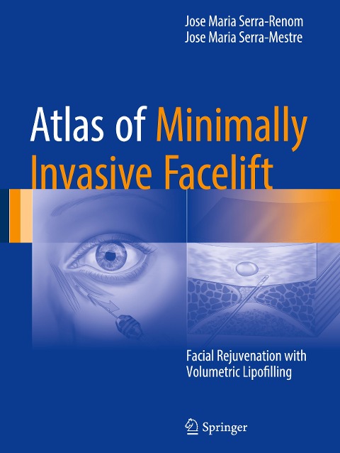 Atlas of Minimally Invasive Facelift: Facial Rejuvenation with Volumetric Lipofilling