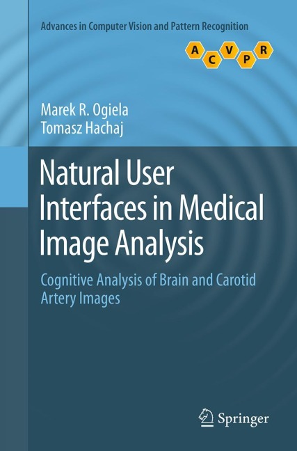 Natural User Interfaces in Medical Image Analysis: Cognitive Analysis of Brain and Carotid Artery Images