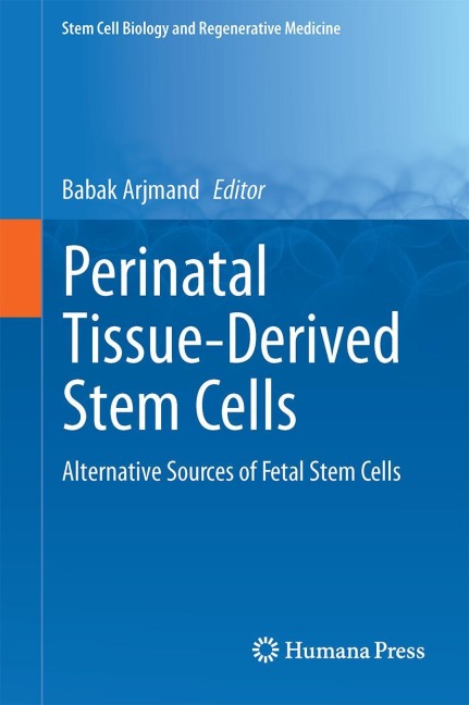 Perinatal Tissue-Derived Stem Cells: Alternative Sources of Fetal Stem Cells