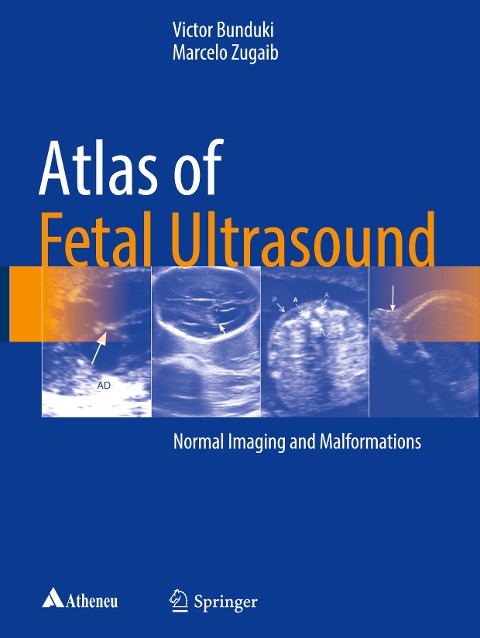 Atlas of Fetal Ultrasound: Normal Imaging and Malformations