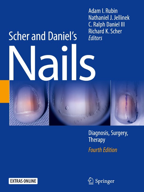 Scher and Daniel's Nails: Diagnosis, Surgery, Therapy