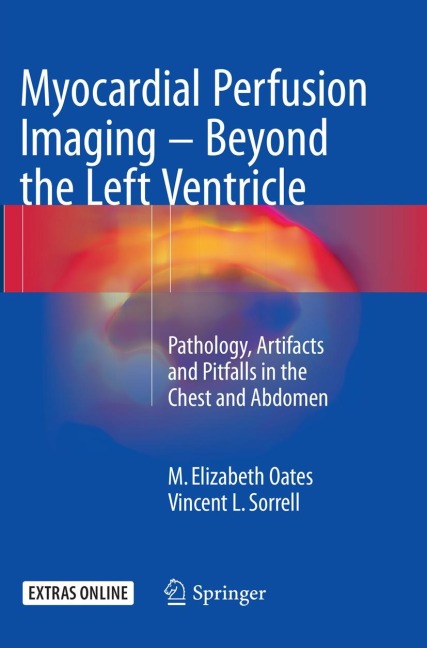 Myocardial Perfusion Imaging - Beyond the Left Ventricle: Pathology, Artifacts and Pitfalls in the Chest and Abdomen