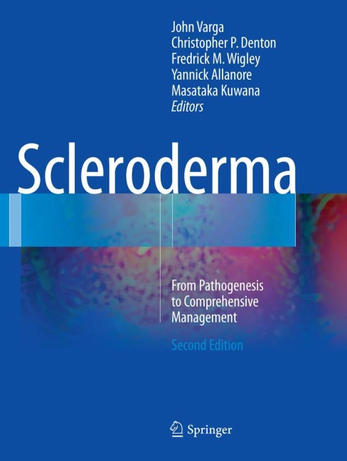 Scleroderma: From Pathogenesis to Comprehensive Management