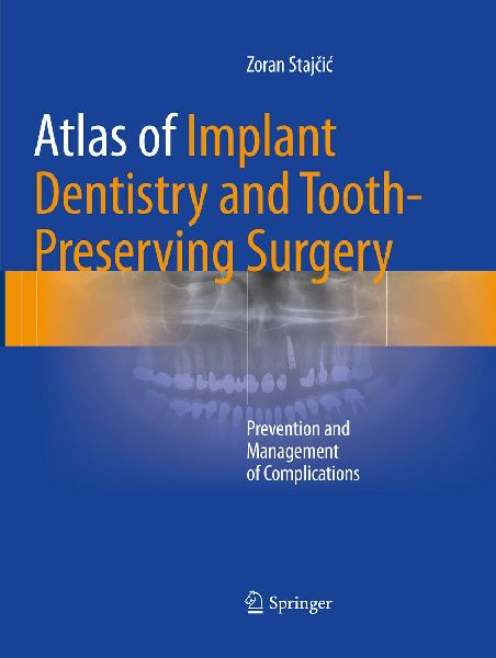 Atlas of Implant Dentistry and Tooth-Preserving Surgery: Prevention and Management of Complications