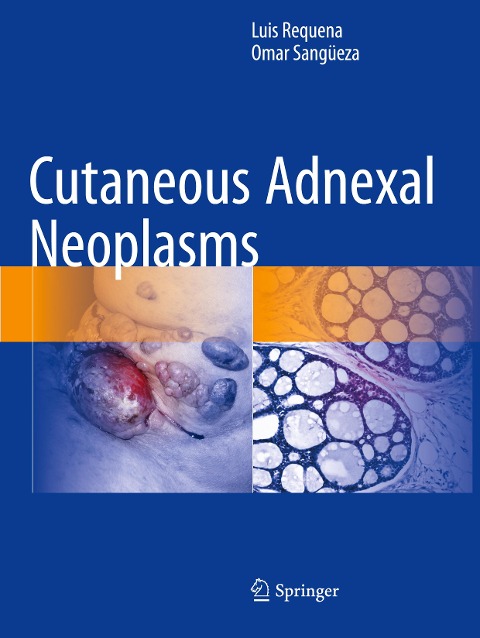 Cutaneous Adnexal Neoplasms