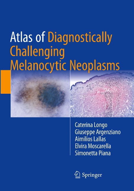 Atlas of Diagnostically Challenging Melanocytic Neoplasms