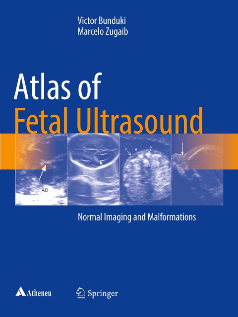 Atlas of Fetal Ultrasound: Normal Imaging and Malformations
