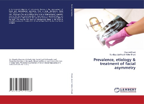 Prevalence, etiology & treatment of facial asymmetry