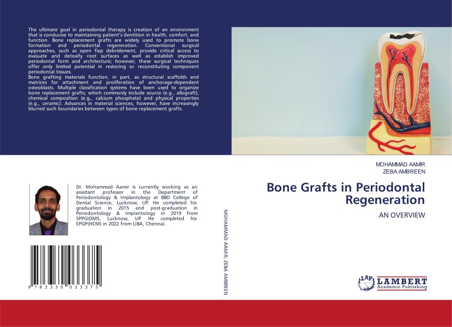 Bone Grafts in Periodontal Regeneration: AN OVERVIEW