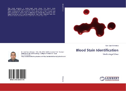 Blood Stain Identification: Medicolegal View
