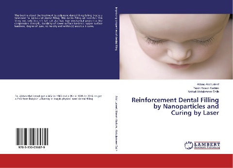 Reinforcement Dental Filling by Nanoparticles and Curing by Laser